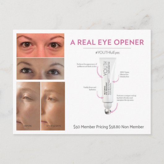 ユースアイトリートメント ポストカード (正面)