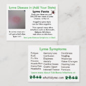 ライム病の州情報カード 名刺 (正面/裏面)