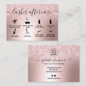 ラッシュアフターモダンケアバラ金ゴールドグリッター金属 名刺 (正面/裏面)