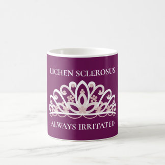 リケン・スケロースス啓発"Always Irritated"マグカップ コーヒーマグカップ