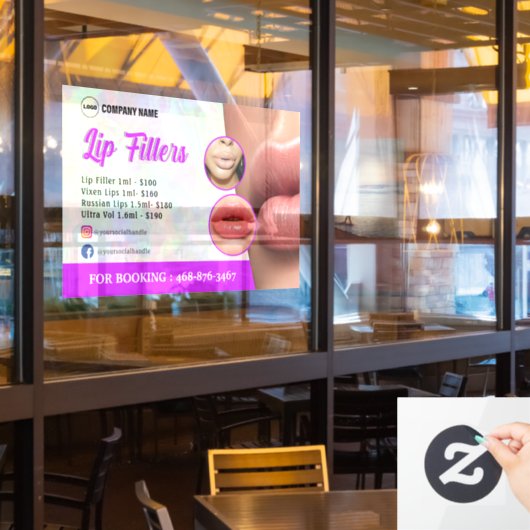 リップフィラーサービスのウィンドウの固定 ウィンドウサイン (レストラン窓)