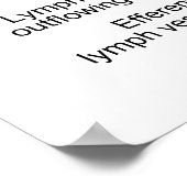 リンパ管へのリンパの流れを示すリンパ節 ポスター (角)