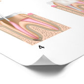 ルート運河トリートメント任意のサイズポスター ポスター (角)