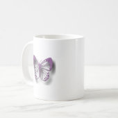 ル祈パ・マグの治療に コーヒーマグカップ (正面左)