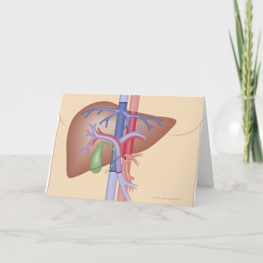 レバー移植のプロシージャ カード (正面)