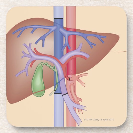 レバー移植のプロシージャ コースター (正面)