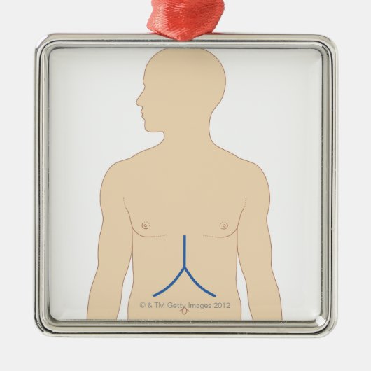 レバー移植 メタルオーナメント (正面)