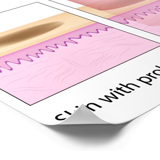レーザー皮膚再表面化手順ポスター ポスター (角)