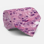 ローサイドーフマン病 ネクタイ (ロール)