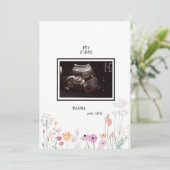 ワイルドフラワー超音波写真ありがとうございまおもしろいす サンキューカード (スタンド正面)