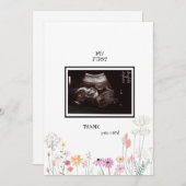 ワイルドフラワー超音波写真ありがとうございまおもしろいす サンキューカード (正面/裏面)