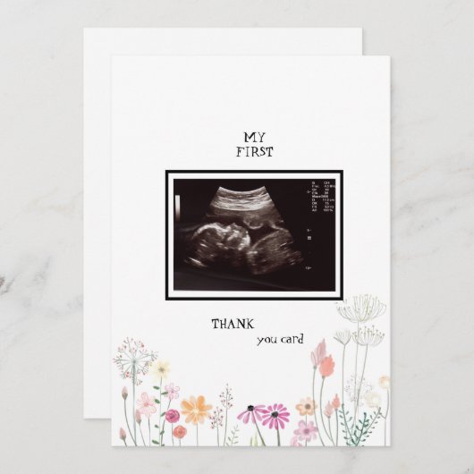 ワイルドフラワー超音波写真ありがとうございまおもしろいす サンキューカード (正面/裏面)