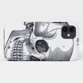 ヴィンテージのスカルの解剖学 Case-Mate iPhoneケース (裏面(横))
