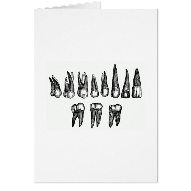 ヴィンテージの歯 (正面)