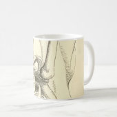 ヴィンテージの解剖学|の肩関節(1852年頃) コーヒーマグカップ (正面右)