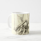ヴィンテージの解剖学|の肩関節(1852年頃) コーヒーマグカップ (正面左)