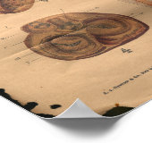 ヴィンテージハート動脈解剖図1906 ポスター (角)