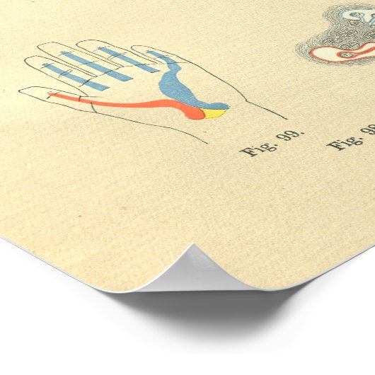 ヴィンテージフロース手関節の解剖学 ポスター (角)