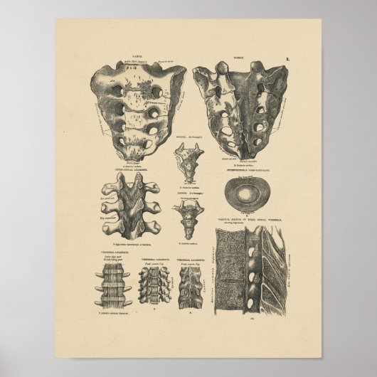 ヴィンテージ脊髄骨1880プリント ポスター (正面)