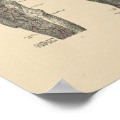 ヴィンテージ脚動脈解剖学1880プリント ポスター (角)