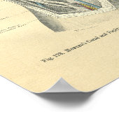 ヴィンテージ膝と脚のフロース解剖学 ポスター (角)