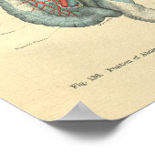 ヴィンテージ解剖学的腸内器官 ポスター (角)