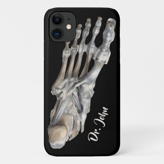 ヴィンテージ解剖学科学、骨格足 Case-Mate iPhoneケース (裏面)