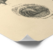 ヴィンテージ鼻のど解剖学1880プリント ポスター (角)