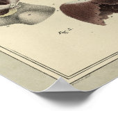 ヴィンテージ1831横隔膜筋解剖学プリント ポスター (角)