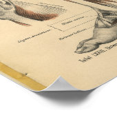 ヴィンテージ1888ドイツ解剖学プリント脚足 ポスター (角)