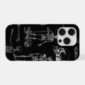 ヴィンテージ スケルトン イラスト スマホケース iPhoneケース (裏面横)
