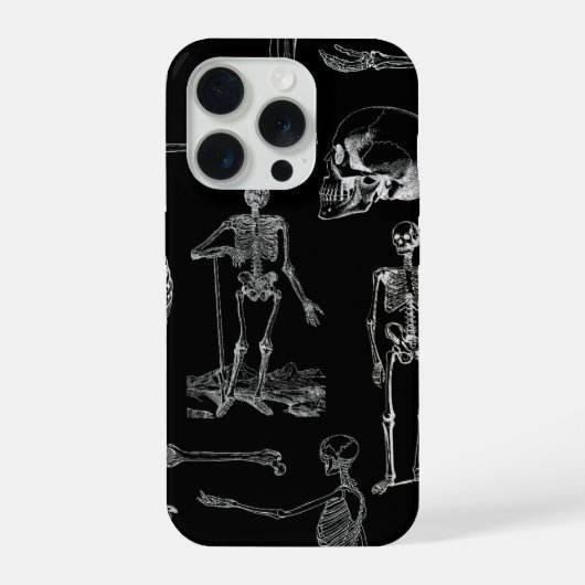 ヴィンテージ スケルトン イラスト スマホケース iPhoneケース (裏面)