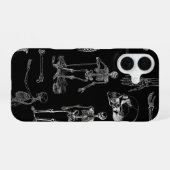 ヴィンテージ スケルトン イラスト スマホケース iPhone 16ケース (裏面横)