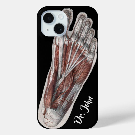 ヴィンテージ 人体解剖学 足跡 皮膚科 足 Case-Mate iPhoneケース (裏面)