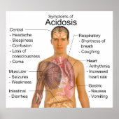 一般的な血中酸性アシドーシス症状 ポスター (正面)