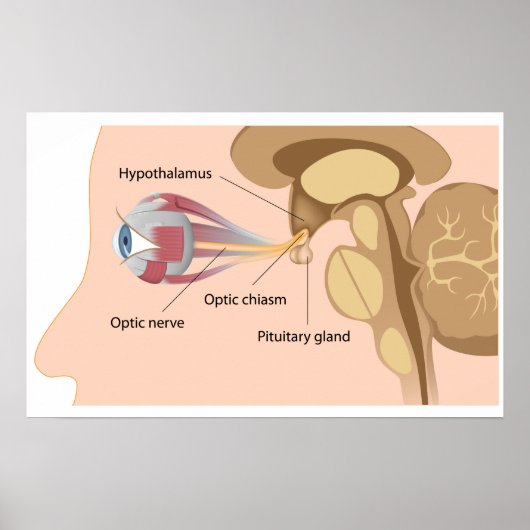 下垂体と視神経性筋腫ポスター ポスター (正面)