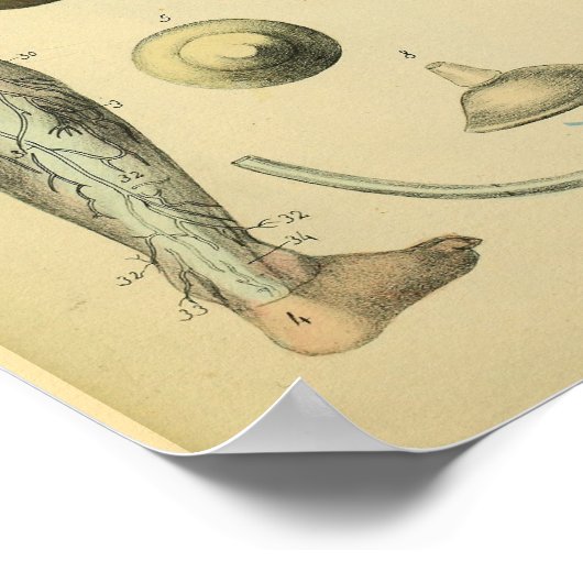 下肢神経解剖学ヴィンテージ医療美術プリント ポスター (角)