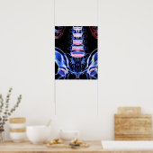 下背面のボーン5 ポスター (キッチン)