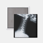 下顎を含む頸椎のX線 マグネット (正面/裏面)