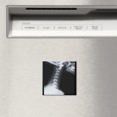 下顎を含む頸椎のX線 マグネット (インサイチュ (食洗機))