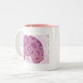 不安障害 ツートーンマグカップ (正面左)