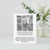 不良なコラーゲンEDSの認識度の郵便はがき ポストカード (スタンド正面)