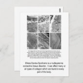 不良なコラーゲンEDSの認識度の郵便はがき ポストカード (正面/裏面)