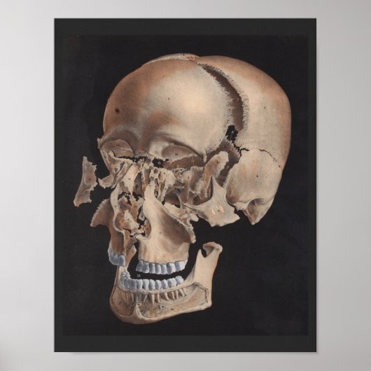 不関節分解スカルプリント ポスター (正面)