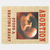 中絶は打つハートをストップ フリースブランケット (正面(横))