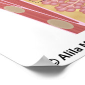 乳がん乳管がん、ラベル付き図。 ポスター (角)