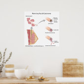 乳がん乳管がん、ラベル付き図。 ポスター (キッチン)