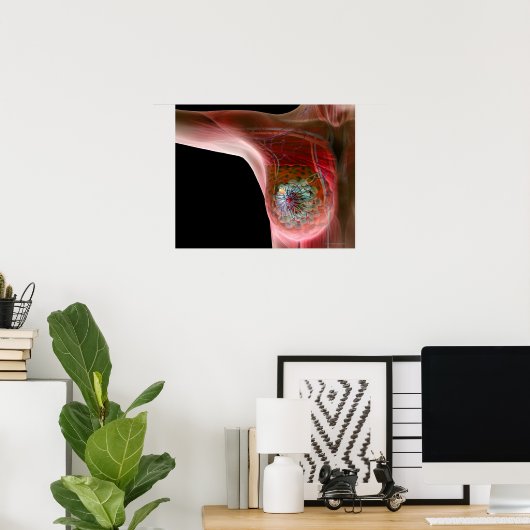 乳がん2 ポスター (ホームオフィス)