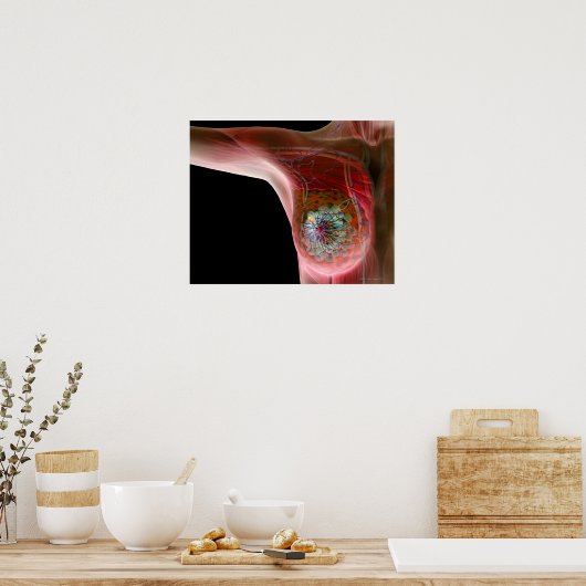 乳がん2 ポスター (キッチン)