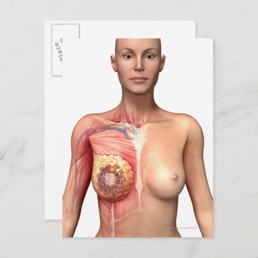 乳がん ポストカード (正面/裏面)